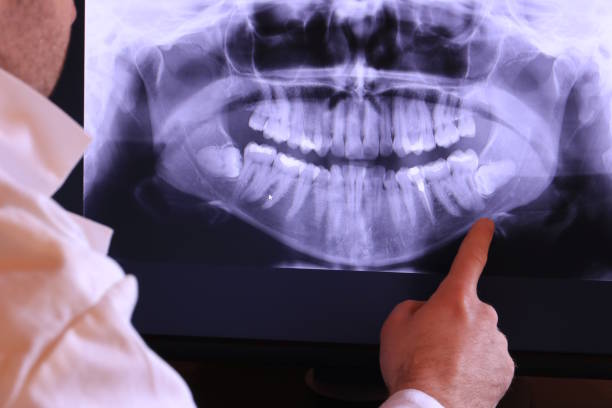 Best Tooth Infection Emergency Dentist  in Wayne, OH